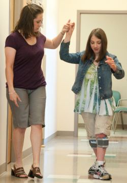Hanger Clinic patient Amber Konkol