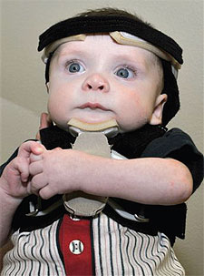 infant with halo immobilization