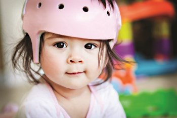 child in cranial helmet